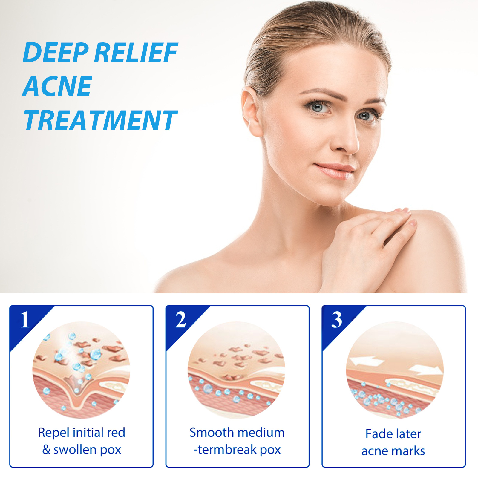 EELHOE Acne Treatment Lotion S - Salicylic Acid Blackhead Remover 评论和价格